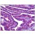 Human Fallopian Tube: Formalin-Fixed, Paraffin-Embedded (FFPE)