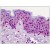 Human Skin: Formalin-Fixed, Paraffin-Embedded (FFPE)