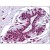 Human Breast: Formalin-Fixed, Paraffin-Embedded (FFPE)