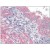 Human Uterus (formalin-fixed, paraffin-embedded) stained with ATF6 antibody AP23812PU-N at 2.5 µg/ml followed by biotinylated anti-goat IgG secondary antibody, alkaline phosphatase-streptavidin and chromogen.