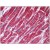 Human Heart: Formalin-Fixed, Paraffin-Embedded (FFPE)