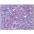 Human Tonsil: Formalin-Fixed, Paraffin-Embedded (FFPE)