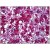 Human Adrenal: Formalin-Fixed, Paraffin-Embedded (FFPE)