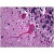 Human Brain, Cerebellum: Formalin-Fixed, Paraffin-Embedded (FFPE)