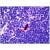 Human Lyphoid-Dendritic Cells: Formalin-Fixed, Paraffin-Embedded (FFPE).