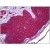 Human Skin: Formalin-Fixed, Paraffin-Embedded (FFPE)