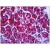 Human Pancreas: Formalin-Fixed, Paraffin-Embedded (FFPE)