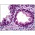 Human Prostate: Formalin-Fixed, Paraffin-Embedded (FFPE)