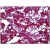 Human Adrenal: Formalin-Fixed, Paraffin-Embedded (FFPE)