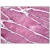 Human Skeletal Muscle: Formalin-Fixed, Paraffin-Embedded (FFPE)
