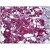 Human Adrenal: Formalin-Fixed, Paraffin-Embedded (FFPE)