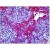 Human Tonsil, Squamous Epithelium: Formalin-Fixed, Paraffin-Embedded (FFPE)