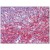 Human Spleen: Formalin-Fixed, Paraffin-Embedded (FFPE)