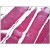 Human Skeletal Muscle: Formalin-Fixed, Paraffin-Embedded (FFPE)