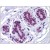 Human Breast: Formalin-Fixed, Paraffin-Embedded (FFPE)