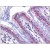 Human Colon: Formalin-Fixed, Paraffin-Embedded (FFPE)
