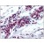 Human Breast: Formalin-Fixed, Paraffin-Embedded (FFPE)