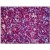 Human Spleen: Formalin-Fixed, Paraffin-Embedded (FFPE)