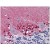 Human Brain, Cerebellum: Formalin-Fixed, Paraffin-Embedded (FFPE)