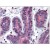 Human Breast: Formalin-Fixed, Paraffin-Embedded (FFPE)