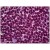 Human Spleen: Formalin-Fixed, Paraffin-Embedded (FFPE)