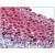 Human Tonsil: Formalin-Fixed, Paraffin-Embedded (FFPE)