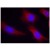 Immunofluorescence staining of paraffin-embedded human hippocampal region tissue from the falling sickness disease using CaMKII antibody