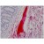Human Blood Plasma: Formalin-Fixed, Paraffin-Embedded (FFPE)