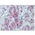 Human Adrenal: Formalin-Fixed, Paraffin-Embedded (FFPE)