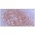 Formalin-Fixed, Paraffin-Embedded Human tonsil stained with CD21 antibody Cat.-No. AM10060SU-N using peroxidase conjugate and DAB chromogen. Note the membrane staining of follicular dendritic cells and their network.