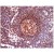 Formalin-Fixed, Paraffin-Embedded Human lymph node stained with CD45 antibody Cat.-No. AM10066SU-N using peroxidase conjugate and DAB chromogen. Note cell membrane staining of B- and T-lymphocytes.