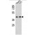AADAT Antibody (Center) (Cat. #AP50010PU-N) western blot analysis in HepG2,Y79 cell line lysates (35ug/lane).This demonstrates the AADAT antibody detected the AADAT protein (arrow)
