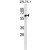 ABCG4 Antibody (N-term) (Cat. #AP50024PU-N) western blot analysis in ZR-75-1 cell line lysates (35 µg/lane).This demonstrates the ABCG4 antibody detected the ABCG4 protein (arrow).