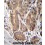 ABHD2 Antibody (Center) (Cat. #AP50026PU-N)immunohistochemistry analysis in formalin fixed and paraffin embedded human stomach tissue followed by peroxidase conjugation of the secondary antibody and DAB staining.This data demonstrates the use of ABHD2 Antibody (Center) for immunohistochemistry. Clinical relevance has not been evaluated.