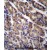 ABRA Antibody (C-term) (Cat. #AP50033PU-N)immunohistochemistry analysis in formalin fixed and paraffin embedded human stomach tissue followed by peroxidase conjugation of the secondary antibody and DAB staining.This data demonstrates the use of ABRA Antibody (C-term) for immunohistochemistry. Clinical relevance has not been evaluated.