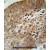 ACD10 Antibody (Center) (Cat. #AP50046PU-N) immunohistochemistry analysis in formalin fixed and paraffin embedded human hepatocarcinoma followed by peroxidase conjugation of the secondary antibody and DAB staining. This data demonstrates the use of the ACD10 Antibody (Center) for immunohistochemistry. Clinical relevance has not been evaluated.