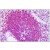 Human Spleen: Formalin-Fixed, Paraffin-Embedded (FFPE)