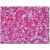 Human Pancreas: Formalin-Fixed, Paraffin-Embedded (FFPE)