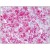 Human Adrenal Cortex: Formalin-Fixed, Paraffin-Embedded (FFPE).