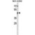 AKR1C4 Antibody (N-term) (Cat. #AP50134PU-N) western blot analysis in NCI-H292 cell line lysates (35 µg/lane).This demonstrates the AKR1C4 antibody detected the AKR1C4 protein (arrow).
