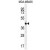 ALX4 Antibody (Center) (Cat. #AP50156PU-N) western blot analysis in MDA-MB435 cell line lysates (35µg/lane).This demonstrates the ALX4 antibody detected the ALX4 protein (arrow).