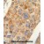 AMACR antibody (C-term) (Cat. #AP50158PU-N) immunohistochemistry analysis in formalin fixed and paraffin embedded human hepatocarcinoma followed by peroxidase conjugation of the secondary antibody and DAB staining. This data demonstrates the use of the AMACR antibody (C-term) for immunohistochemistry. Clinical relevance has not been evaluated.