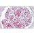 Human Kidney: Formalin-Fixed, Paraffin-Embedded (FFPE)