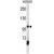 AP2B1 Antibody (Center) (Cat. #AP50201PU-N) western blot analysis in A2058 cell line lysates (35µg/lane).This demonstrates the AP2B1 antibody detected the AP2B1 protein (arrow).