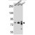 ARHGAP22 Antibody (C-term) (Cat. #AP50235PU-N) western blot analysis in MDA-MB231,WiDr,ZR-75-1 cell line lysates (35µg/lane).This demonstrates the ARHGAP22 antibody detected the ARHGAP22 protein (arrow).