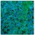 In this tissue section through an e13 Mouse brain, PLP (green staining) can be seen in immature oligodendrocytes of white matter tracts. DAPI (blue staining) allows visualization of nuclei.