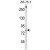 BACH1 Antibody (C-term) (Cat. #AP50333PU-N) western blot analysis in ZR-75-1 cell line lysates (35µg/lane).This demonstrates the BACH1 antibody detected the BACH1 protein (arrow).