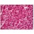 Human Pancreas: Formalin-Fixed, Paraffin-Embedded (FFPE)