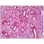Formalin-Fixed, Paraffin-Embedded  Human Human Kidney, Tubules stained with Aldolase A / ALDOA Antibvody Cat.-No AM31917PU-N (Clone 2E6) at 5 µg/ml after heat-induced antigen retrieval.