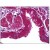 Human Lung, Epithelium: Formalin-Fixed, Paraffin-Embedded (FFPE)